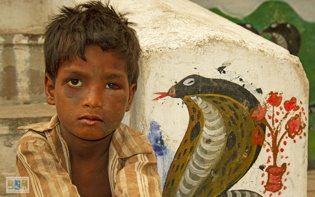 राजस्थान में सर्पदंश से जुड़े मुद्दे और मुश्किलें