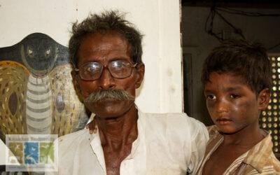 Snakebite: Challenges in Rajasthan